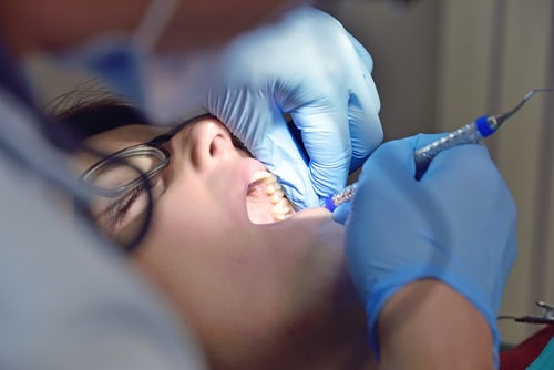 Dental Team in NC Offers 14 Expert Tips to Help Prevent Cavities