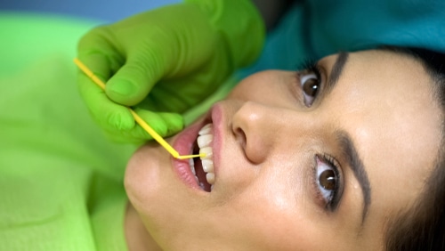Preserving Smiles: The Role of Sealants in Preventing Tooth Decay