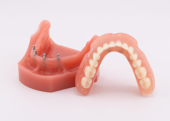 Snap In Dentures in North Carolina | Free Implant Consultations