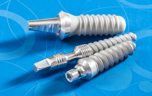 Best Implant Options in 2026 | Implant Dentist in North Carolina
