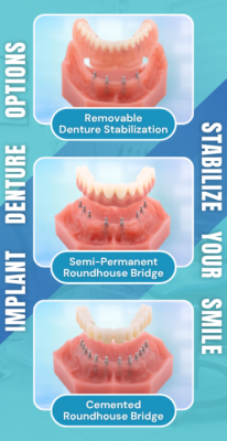 Prótesis dentales en Raleigh, Carolina del Norte: opciones asequibles de implantes cerca de mí