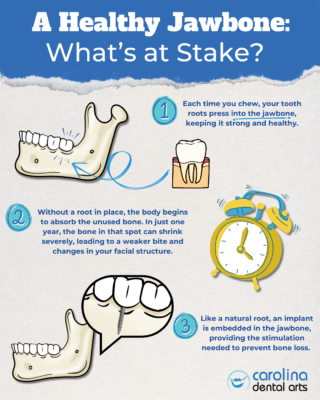 Types of Dental Implants in North Carolina | Free Consultations