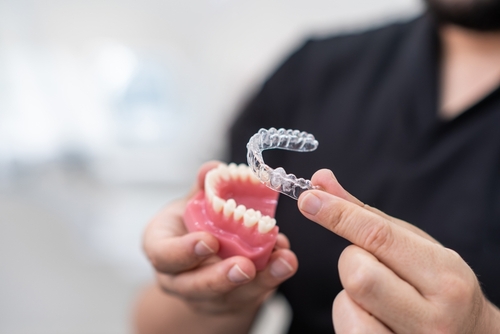Invisalign in Raleigh, NC | Free Clear Aligner Consultations