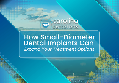 Small-Diameter Dental Implants in North Carolina | Free Consults